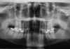 7 cosas curiosas para ampliar tu conocimiento hoy – Vol. 1 cosas vistas radiografia rayos x
