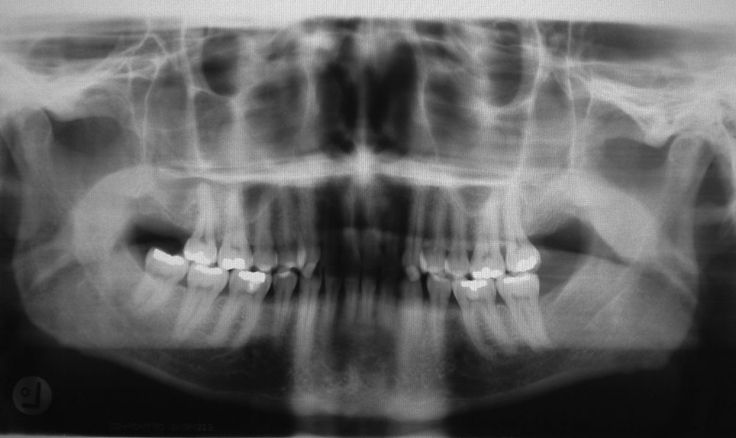 7 cosas curiosas para ampliar tu conocimiento hoy – Vol. 1