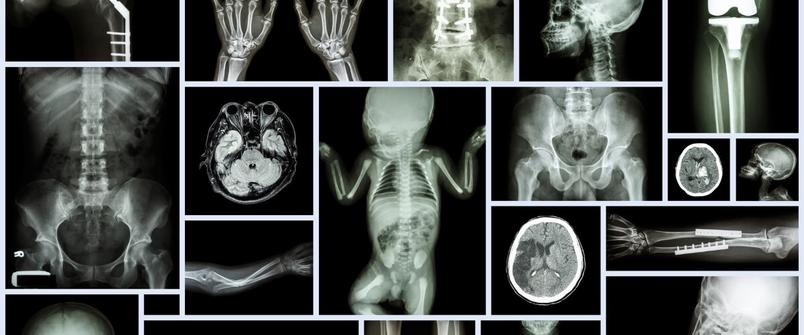 Radiografias de bebe