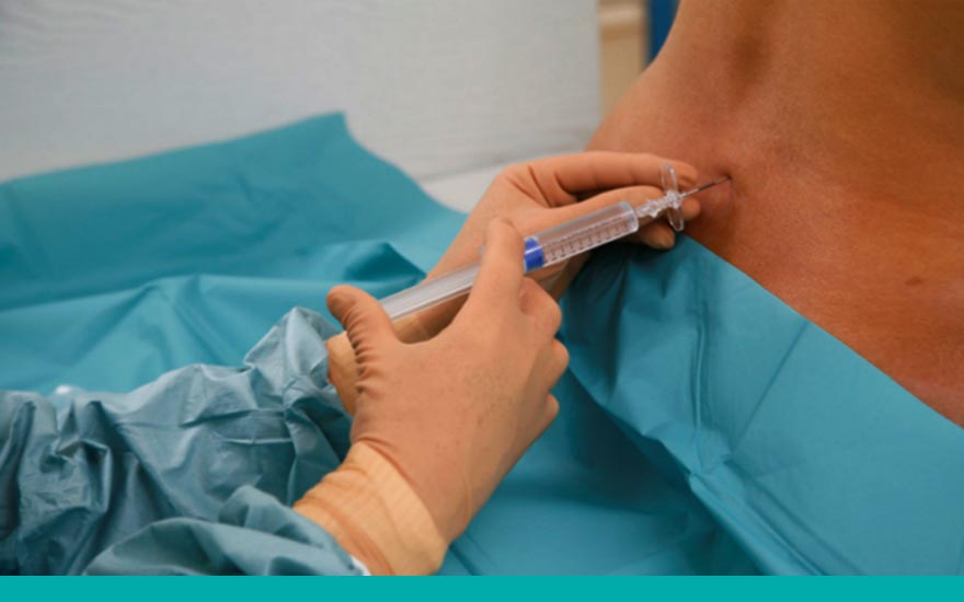 Médico aplicando anestesia epidural a una paciente